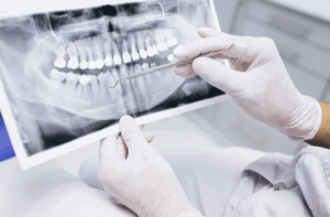 רופא שיניים מציג שתלים שונים של שיניים